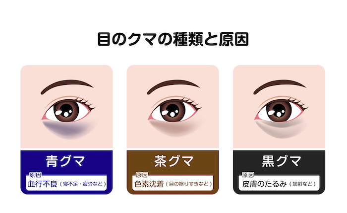 素敵なお客様ご紹介！その１１７２チヨダメガネ