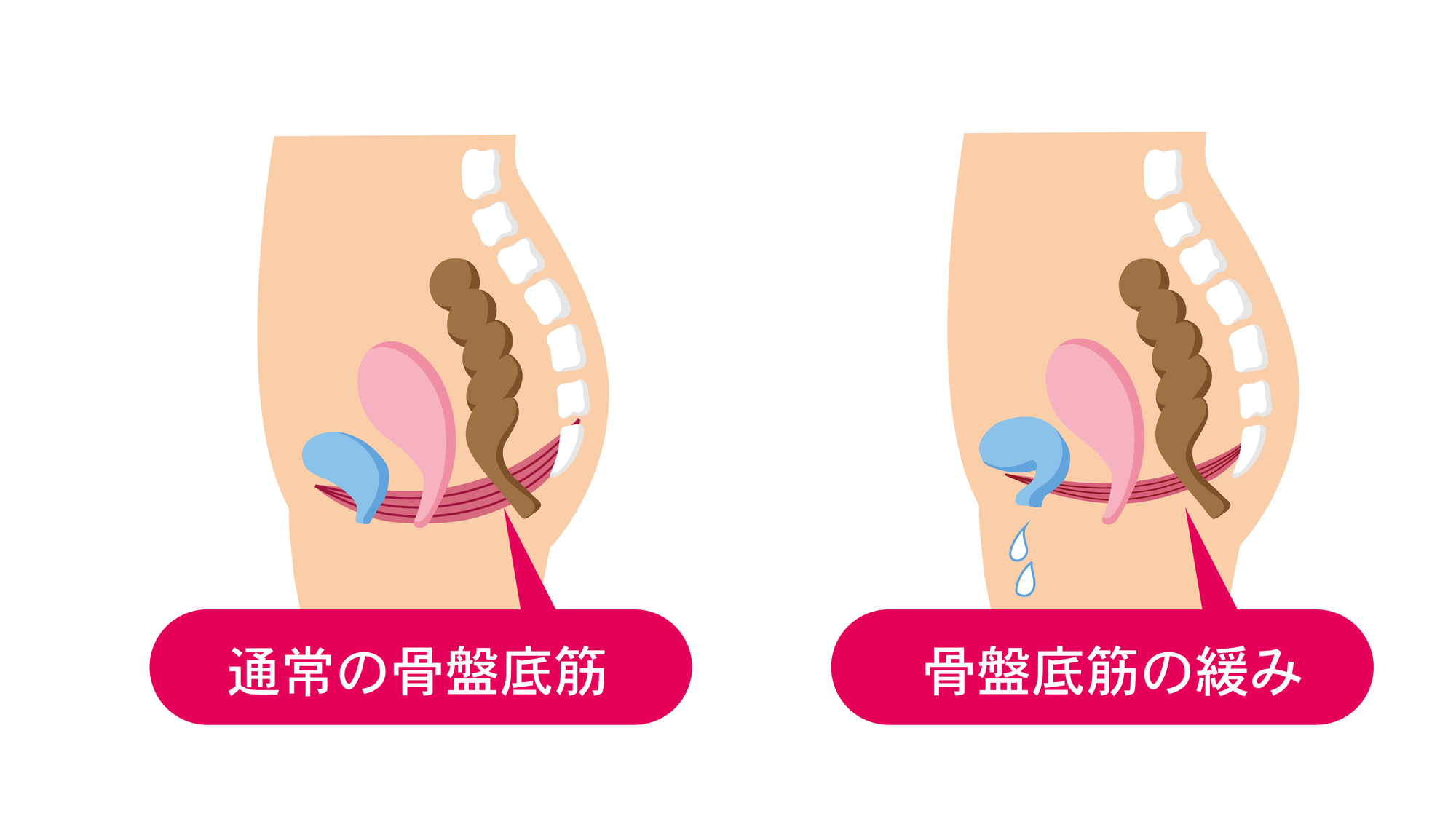 デリケートゾーンがかゆい！陰部のかゆみの原因や対処法、受診の目安について解説 | 二宮レディースクリニック【泌尿器科・婦人科・アートメイク】