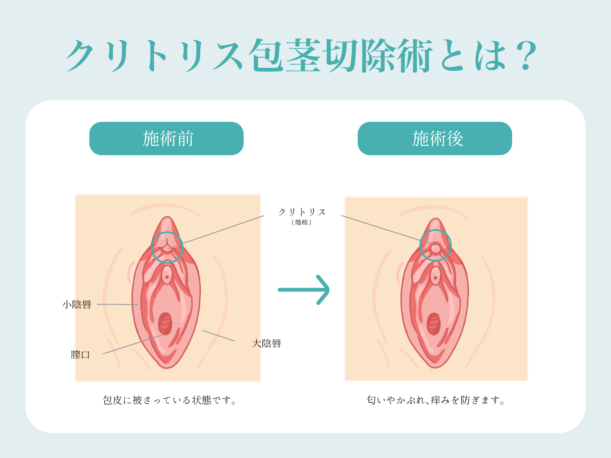 感度を上げたい女性必見！セックスでイキやすい体になる、ひとりエッチのやりかた - 女性の絶頂ブログ