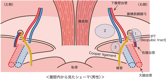 写真・画像】【消化器外科編]】鼠径ヘルニア 春の健康特集2018 | |