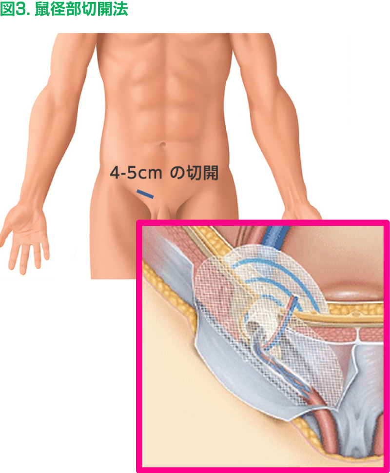 リンパ 鼠径部 マッサージに関するサロン relaxation