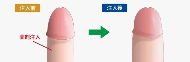 アソコが大きい方が気持ちいいは勘違い？セックスのときの女子の本音を調査！ | ファッションメディア - andGIRL