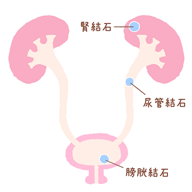 膀胱炎とセックス セックスでの膀胱炎の予防法を紹介 - TENGAヘルスケア プロダクトサイト