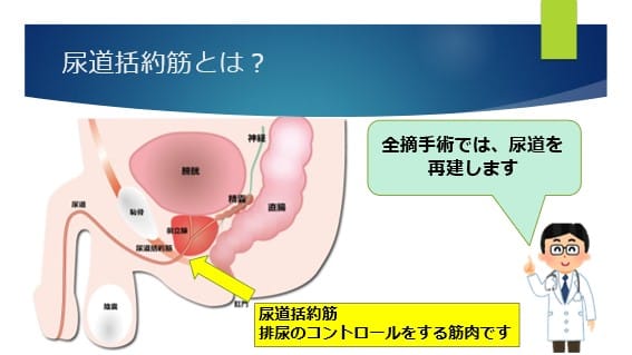 なぜ慢性前立腺炎/慢性骨盤痛症候群で頻尿になる？｜伊藤 千展@おしっこ問題✖️鍼灸