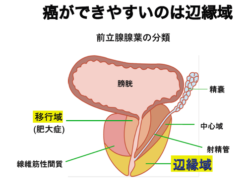 ED・AGAの治療および薬の院内処方｜【公式】静岡第一クリニック » 前立腺肥大でED併発？・・PC筋トレーニングで復活