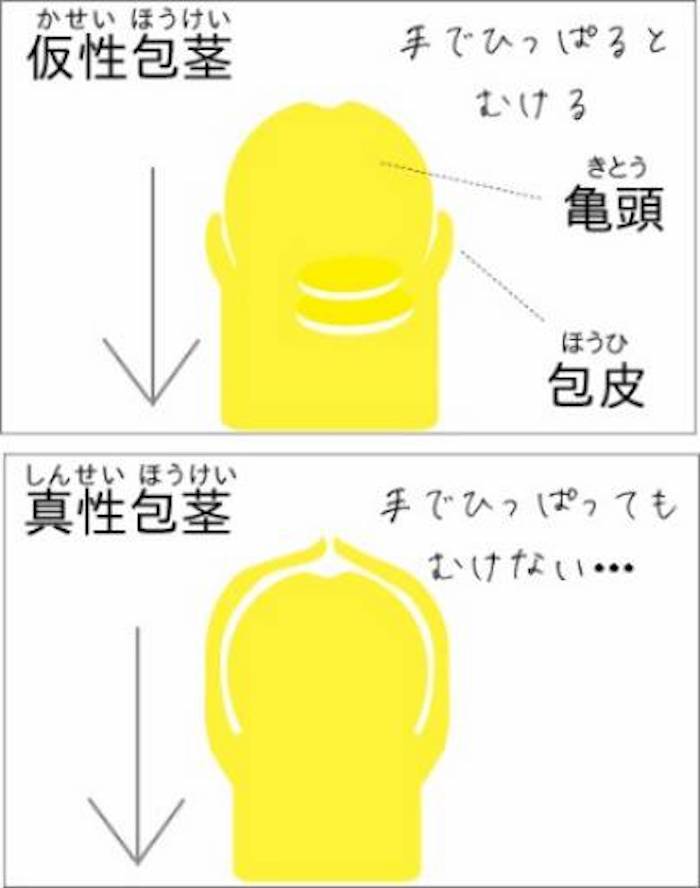 2024年】包茎手術のおすすめクリニック13院！ 後悔しない選び方、費用や手術方法を比較 | GOETHE