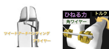 矯正器具南千住の矯正歯科 南千住小児歯科矯正歯科 土日診療