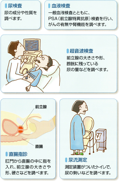 診療内容 | まつもと泌尿器科