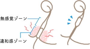 看護師とーふ｜1分で学べてすぐに使える内視鏡の知識 | @tofu_endoscopy.ns 👈すぐに役立つ内視鏡の知識！