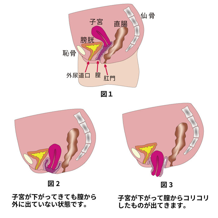 加齢で膣圧下がってない？尿もれ・お腹ぽっこりは「骨盤底筋強化」で解消！【寝たまま骨盤底筋トレ】 | ヨガジャーナルオンライン