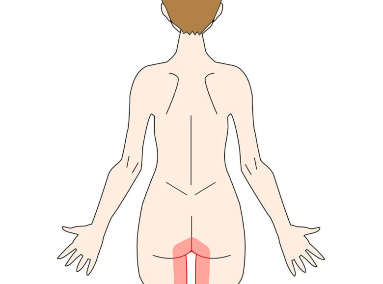 前立腺炎（慢性前立腺炎） | 慢性痛治療の専門医による痛みと身体のQ＆A