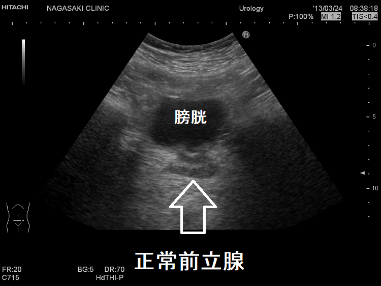 子宮腺筋症 | ワタシのカラダ相談室