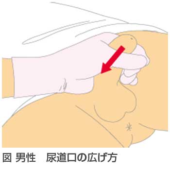 体温測定時に、体温計を前方下から斜めに挿入し、保持するのはなぜ？｜看護技術 | 看護roo![カンゴルー]