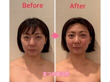 小顔エステ体験者の生の口コミを集めました！効果・料金・メニューなど5項目を徹底調査 | SlimMagazine