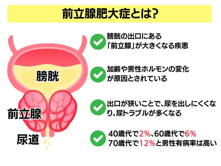 前立腺責めのやり方とコツ！気持ちいい前立腺マッサージの方法をイラストで解説