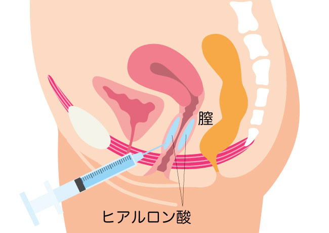 【自腹でデータ入手！】クリトリスの全景こんな感じ！カラダを知るお風呂場