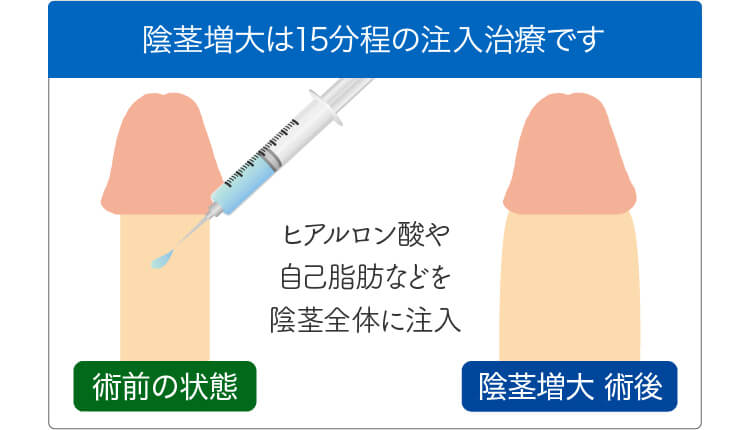 でかいちんこの基準とは？日本人平均や大きくする方法を解説 |【公式】ユナイテッドクリニック