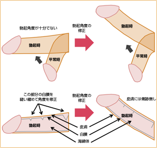 勃起下反りちんぽを鑑賞2本立て - XVIDEOS.COM