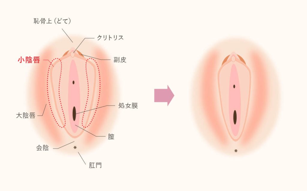 清純娘のアワビ型マンコ : 山本リンヂ偏奇館