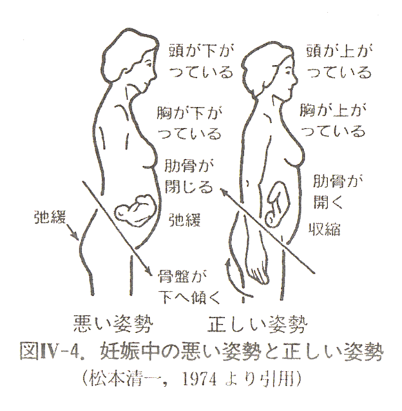 鼠径ヘルニアとは 放置は危険、日帰り手術でも治せる カラダづくり -