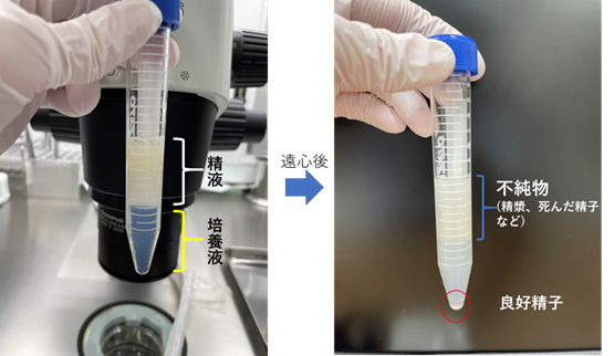 精子提供します 広がるSNS精子提供 リスクと多様化する家族の形 -