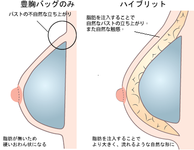 アナタは知ってる？バストの基礎知識とエイジング対策。アナタは知ってる？バストの基礎知識とエイジング対策。