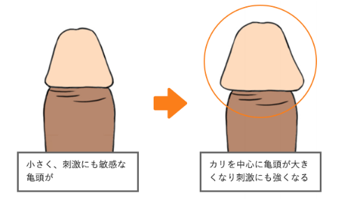 早漏改善治療｜MSクリニック横浜