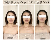 武蔵小杉 ヘッドスパ専門店 Re:youa（リユーア） 頭皮と髪のお悩みを根本改善