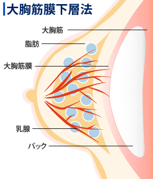 ほとんどの男子が知らない寝バックのやり方！抜けないコツも徹底解説｜駅ちか！風俗雑記帳