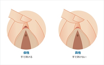 クリ絶頂 クリ剥きの極丨大人のおもちゃとアダルトグッズ専門店ワイルドワン