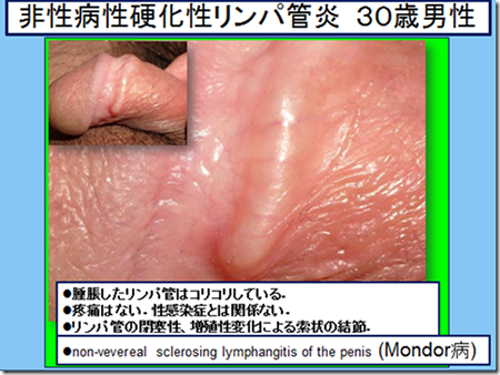 駿河屋 -【アダルト】<中古>有名進学校の女子校生が初めてのオナニー鑑賞! 至近距離でのガマン汁臭とシコシコ音にグッチョリ膣キュン!  頬を赤らめて求めて来たので生挿入、中出ししちゃいました!（ＡＶ）