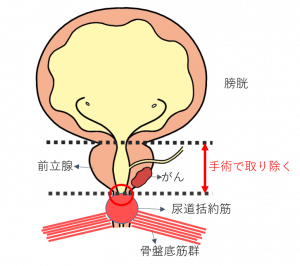 前立腺マッサージとはどんなプレイ？ 風俗エステ嬢がやり方を詳細解説 | シンデレラグループ公式サイト