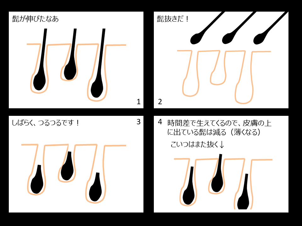 癖になっていたら要注意】ヒゲ（髭）を抜くことで招きうるリスクの代表例と改善方法一覧