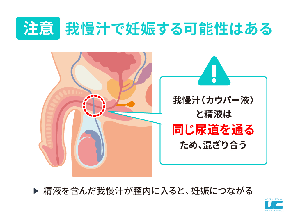 我慢汁の増やし方とは？我慢汁の正体・出ない原因・増やすメリットを解説 | ザヘルプM