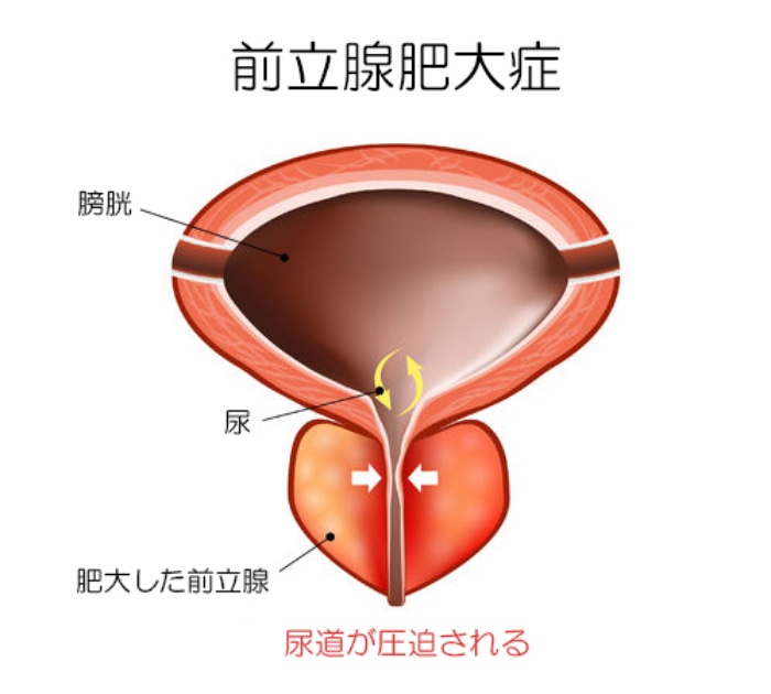 これから前立腺マッサージを始めたい方へ | アネロスジャパン | ANEROS