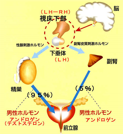 前立腺がん手術後の「尿漏れ」を解消する「人工尿道括約筋」 （2ページ目）：必ず役立つ 治療と検査のプランX：日経Gooday（グッデイ）