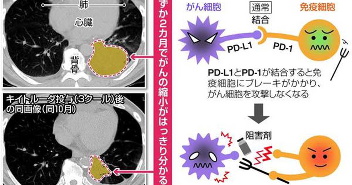 再生医療の名医が語る！瀬田クリニック東京　後藤院長編【その④】