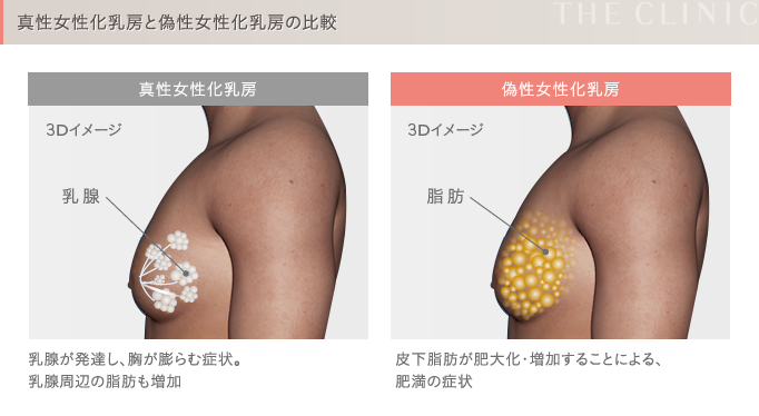 男の胸の脂肪はコレで落とそう！腕立て伏せじゃ落ちない？ - Fitmo