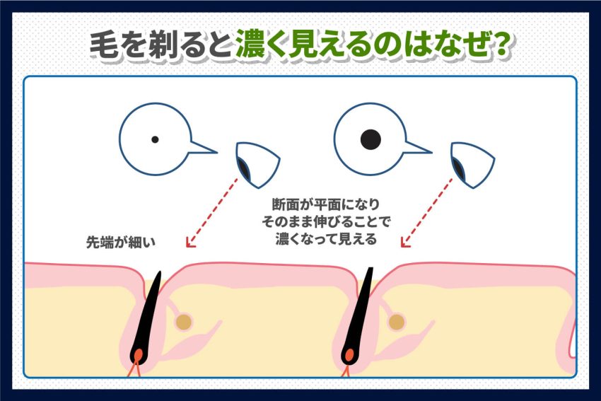 女性でもひげが生える？剃ると濃くなる？正しい処理法と対策・ケア方法を紹介 - プリートスキン｜脱毛情報・知識のWEBメディア