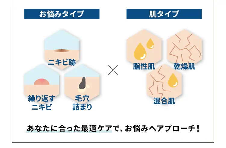 美容医療とエステの力でニキビ改善！ニキビメディカルコース｜ニキビのお悩みならお任せ！エステティックサロン【ラ・パルレ】公式