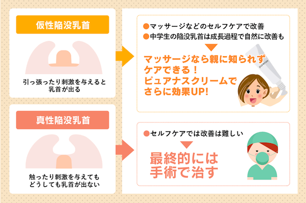 乳首の色問題 | 50代からの雌活