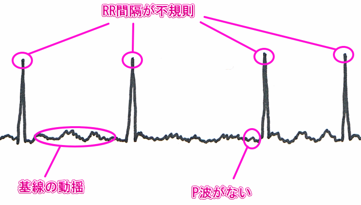 楽天市場】エアフライ AirFly サングラス 調光 AF-301