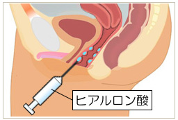 ミミズ千匹、数の子天井｜まっ９のブログ｜エネルギー充填中 - みんカラ