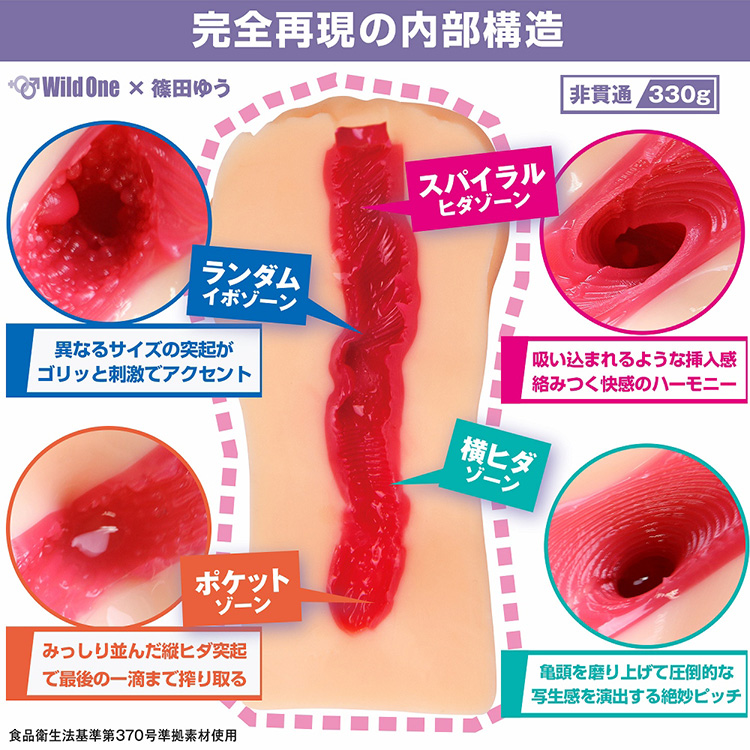 膣ヒアルロン酸１０ｃｃ＋名器形成｜婦人科形成の症例紹介｜銀座の美容外科・皮膚科ならルーチェクリニック