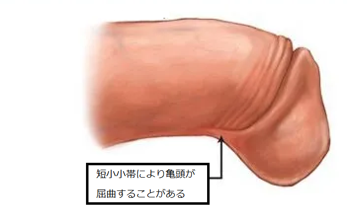 包茎手術・包茎治療｜包茎の手術や治療は認定専門医に！｜[東京・大阪]