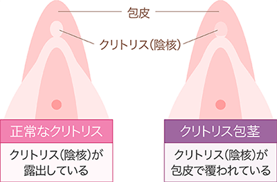 女性器の形や構造・役割について｜婦人科形成の施術・後悔しない注意点を紹介 | 銀座マイアミ美容外科