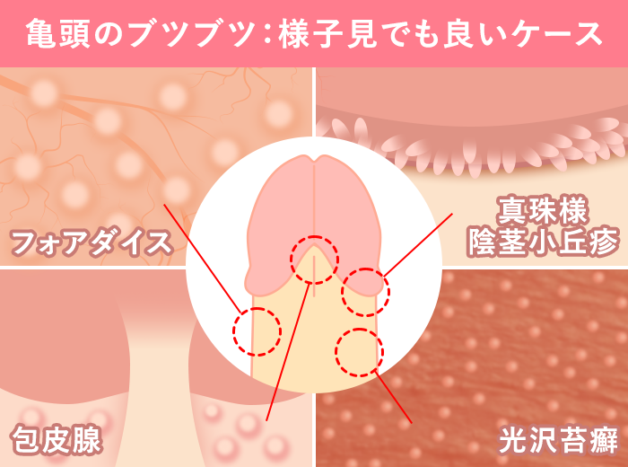 カリ｜大人のおもちゃ用語辞典