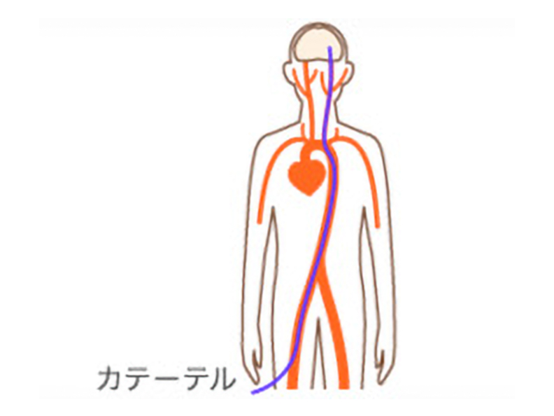 尻や鼠径部が痛い原因は仙腸関節障害かも - 名古屋市 ふるさわ指圧治療院