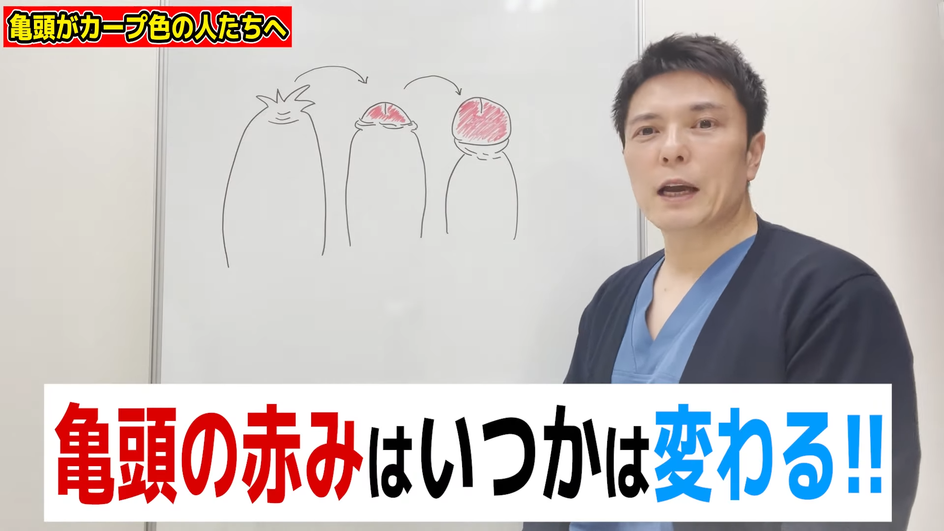 カントン包茎（嵌頓包茎）とは？手術と費用について｜MSクリニック