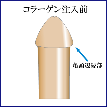 医師監修】ペニスの構造とその役割とは？個人差は？ | メンズライフクリニック【公式】